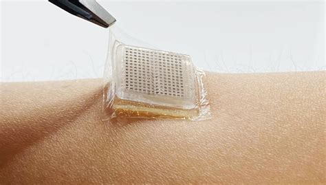 This Stamp-Sized Ultrasound Patch Can Image Internal Organs