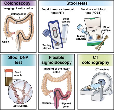 Patients prefer stool test to colonoscopy